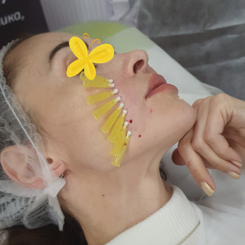 Отримали гарний, помітний результат 
  