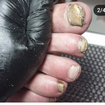 Чоловічий апаратний педикюр
                    Майстер манікюру  Київ