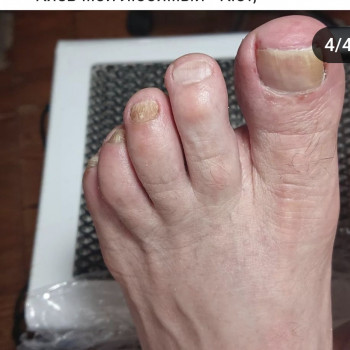 Чоловічий апаратний педикюр
                    Майстер манікюру  Київ