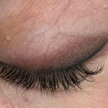 Загоєна стрілка з розтушовкою