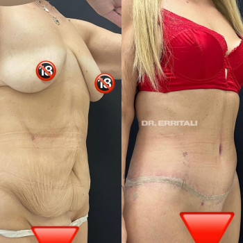 Абдель Эрритали, Харків Фото - 65