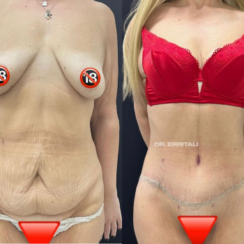 Абдель Эрритали, Харків Фото - 69