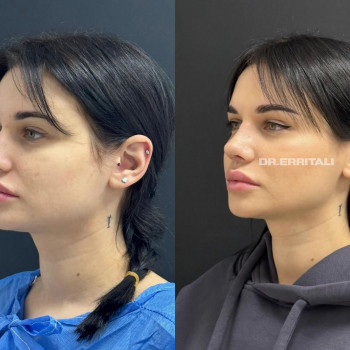 Абдель Эрритали, Харків Фото - 64