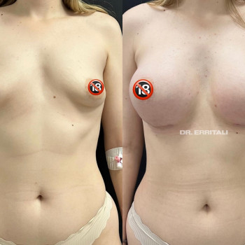 Абдель Эрритали, Харків Фото - 74