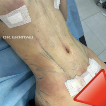 Абдель Эрритали, Харків Фото - 53