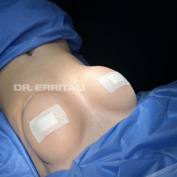 Абдель Эрритали, Харків Фото - 57