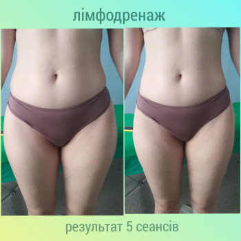 Антицелюлітний курс з обгортанням
                    Массажист Юлія Киев