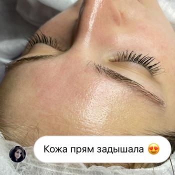 Ретиноловий пілінг
                    Дерматолог косметолог Анастасия Киев