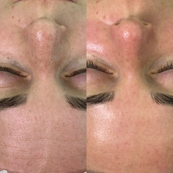 Анастасія Лескович, Київ Фото - 10