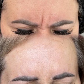 Ботокс
                    Мастер эпиляции Янітта Киев