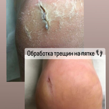 Наталья Балаховская, Кременчуг Фото - 80