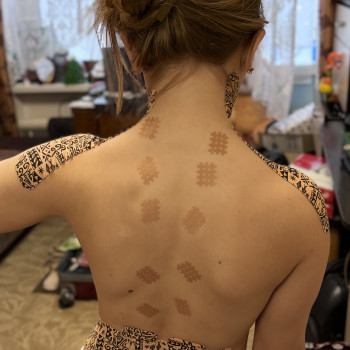 Кінезіотейпування
                    Реабілітолог Алина Суми