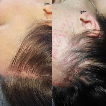 Тетяна Ткаченко, Київ Фото - 11