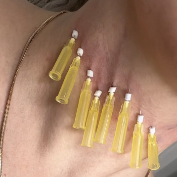 Мононити; нитевой лифтинг; мононитки
                    Майстер епіляції Янітта Київ