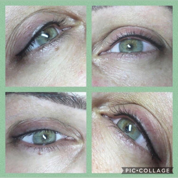 Міжвійка стрілочкп