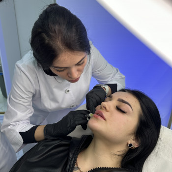 Збільшення губ
                    Косметолог Татьяна Вінниця