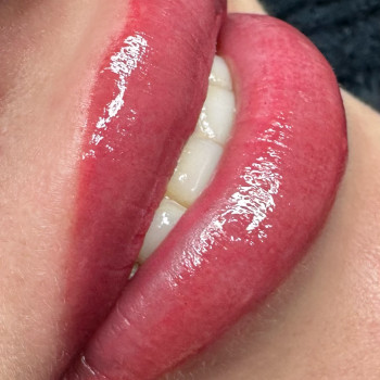 Наталія Савенок, Чернігів Фото - 8