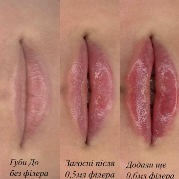 Катерина Товмашенко, Днепр Фото - 22