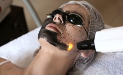 Карбоновий пілінг Косметолог-естетист Екатерина Кременчук