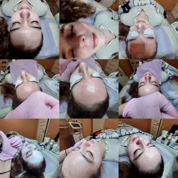 Процесс 7-этапной комбинированной чистки лица.
  чистка лица Котовского Суворовский р