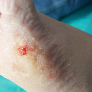 Анжела Кротенко, Кропивницький Фото - 41