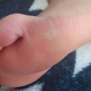 Анжела Кротенко, Кропивницький Фото - 44