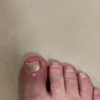 Анжела Кротенко, Кропивницький Фото - 46