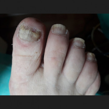 Анжела Кротенко, Кропивницький Фото - 50