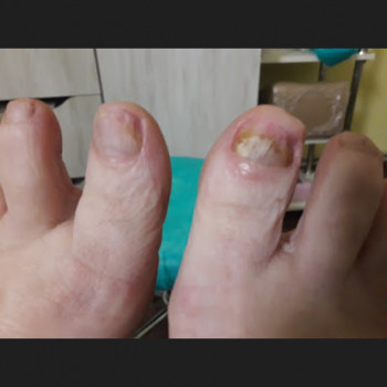 Анжела Кротенко, Кропивницький Фото - 51