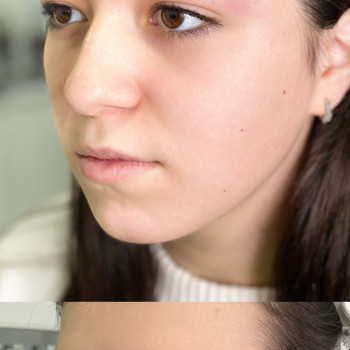 Валерія Мала, Винница Фото - 11