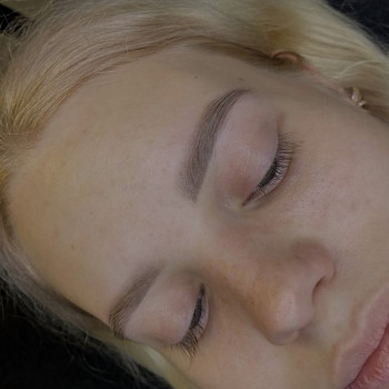 Зажившие брови