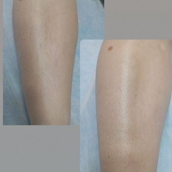 Світлана Тарченко, Николаев Фото - 13