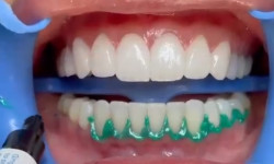 Естетична стоматологія Стоматологическая клиника  Харьков