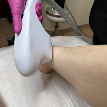 Лазерная эпиляция; лазерна епіляція
                    Мастер эпиляции Янітта Киев