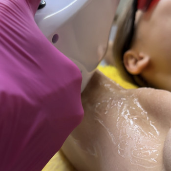 Лазерная эпиляция; лазерна епіляція
                    Мастер эпиляции Янітта Киев