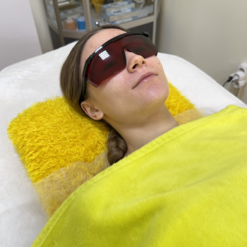 Лазерная эпиляция; лазерна епіляція
                    Мастер эпиляции Янітта Киев