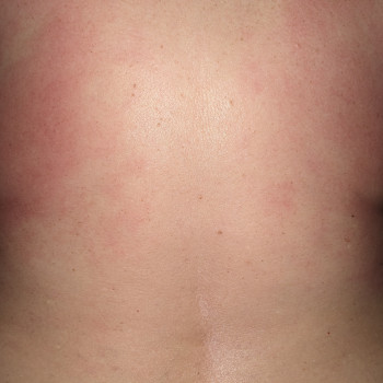 Массаж спины
                    Массажист Валентина Кременчуг