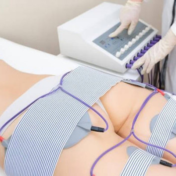 Мілстимуляція.