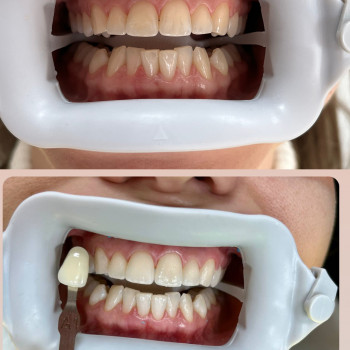 Інна Тимчук, Винница Фото - 10