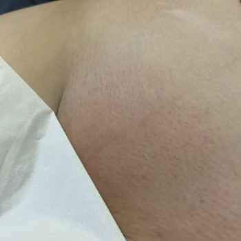 Бікіні 20 хв, 380 грн