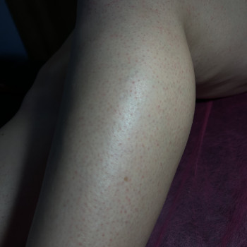 Голені, 30 хвилин, 300 грн