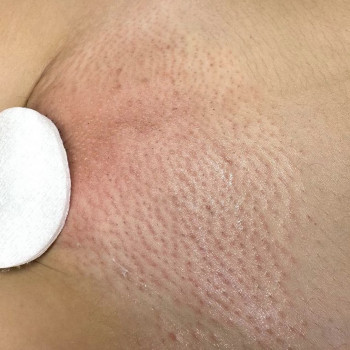 Тетяна Коннікова, Дніпро Фото - 6