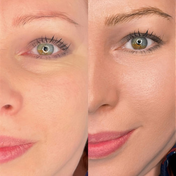 Валерія Мандзюк, Софіївська Борщагівка Фото - 10