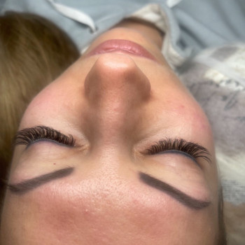 Нарощування вій
                    Косметолог-ін'єкціоніст Маша Київ