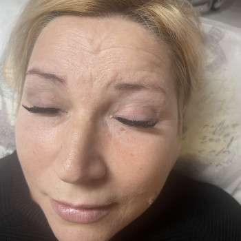 Нарощування вій
                    Косметолог-ін'єкціоніст Маша Київ