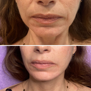 Яна Плахотна, Дніпро Фото - 5