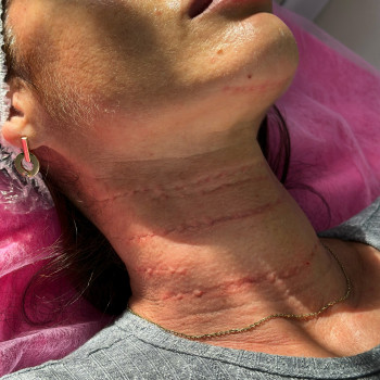 Тетяна Асколіна, Вінниця Фото - 6