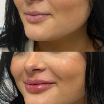 Тетяна Асколіна, Вінниця Фото - 9