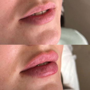 Тетяна Асколіна, Вінниця Фото - 13