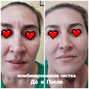   чисткаодеса